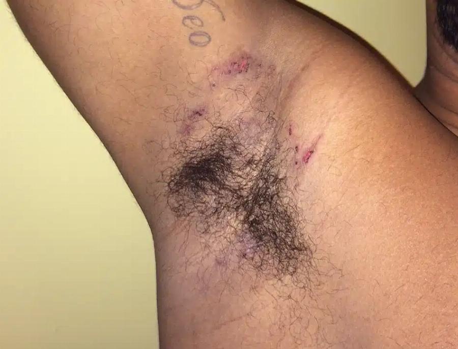 Εκεί που έκανε μπάνιο, ένιωσε κάτι να τον Kαiει κάτω από τη μασχάλη – Δεν ήταν, όμως, το σαπούνι… Ήταν κάτι XEIPOTEPO…