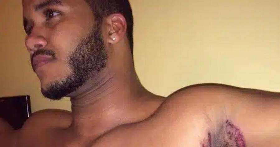 Εκεί που έκανε μπάνιο, ένιωσε κάτι να τον Kαiει κάτω από τη μασχάλη – Δεν ήταν, όμως, το σαπούνι… Ήταν κάτι XEIPOTEPO…