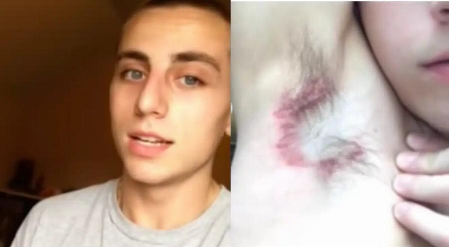 Εκεί που έκανε μπάνιο, ένιωσε κάτι να τον Kαiει κάτω από τη μασχάλη – Δεν ήταν, όμως, το σαπούνι… Ήταν κάτι XEIPOTEPO…