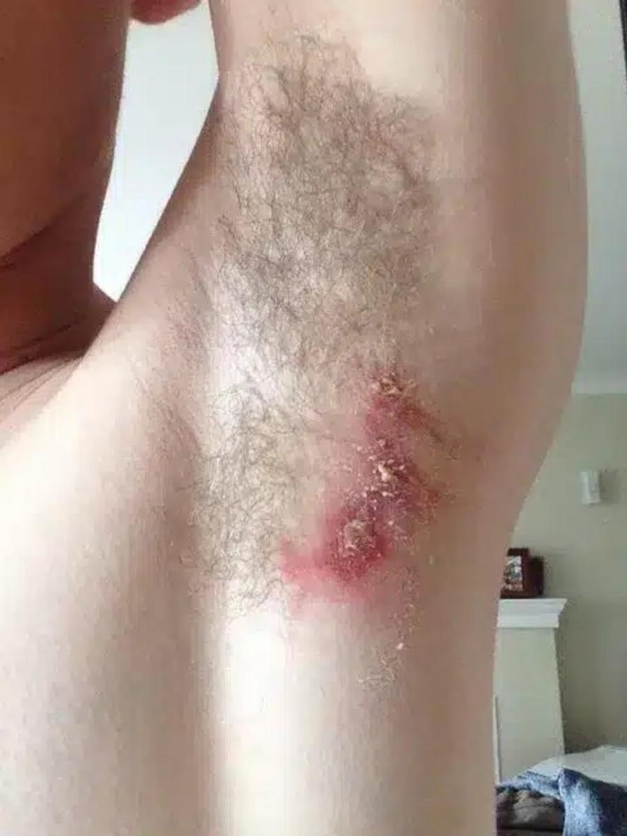 Εκεί που έκανε μπάνιο, ένιωσε κάτι να τον Kαiει κάτω από τη μασχάλη – Δεν ήταν, όμως, το σαπούνι… Ήταν κάτι XEIPOTEPO…