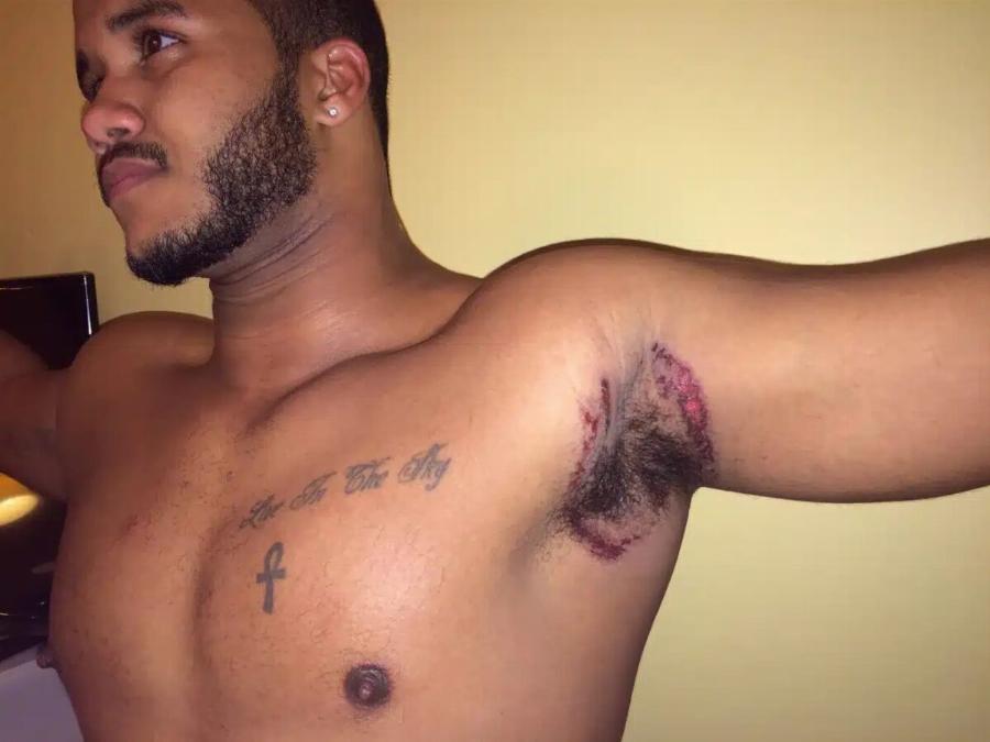 Εκεί που έκανε μπάνιο, ένιωσε κάτι να τον Kαiει κάτω από τη μασχάλη – Δεν ήταν, όμως, το σαπούνι… Ήταν κάτι XEIPOTEPO…