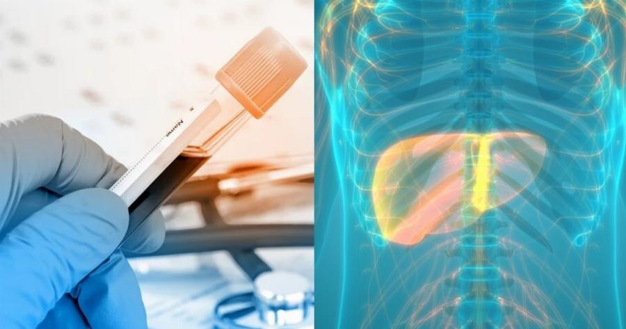 Αν η ανάσα σας έχει αυτή την μυρωδιά, πρέπει να κάνετε εξετάσεις ήπατος ΑΜΕΣΩΣ