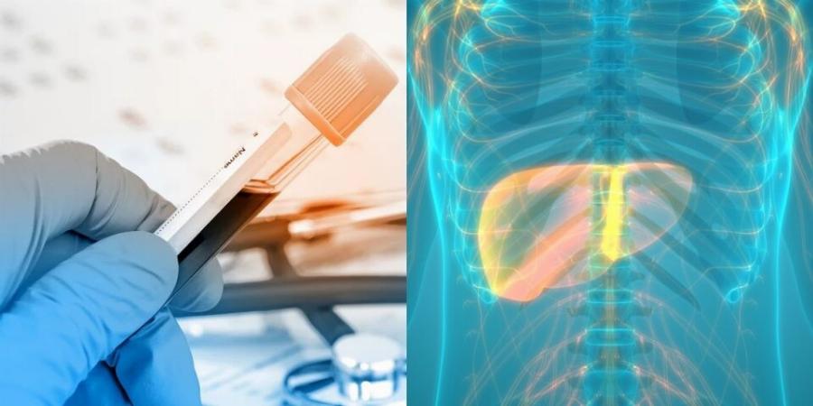 Αν η ανάσα σας έχει αυτή την μυρωδιά, πρέπει να κάνετε εξετάσεις ήπατος ΑΜΕΣΩΣ