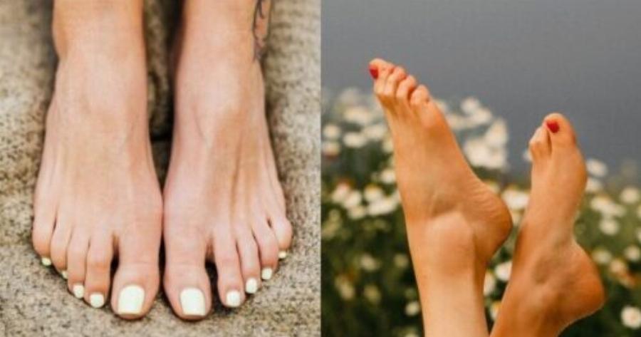 Νύχια και υγεία: Έξι ανησυχητικά σημάδια – Με ποιες παθήσεις συνδέονται πραγματικά