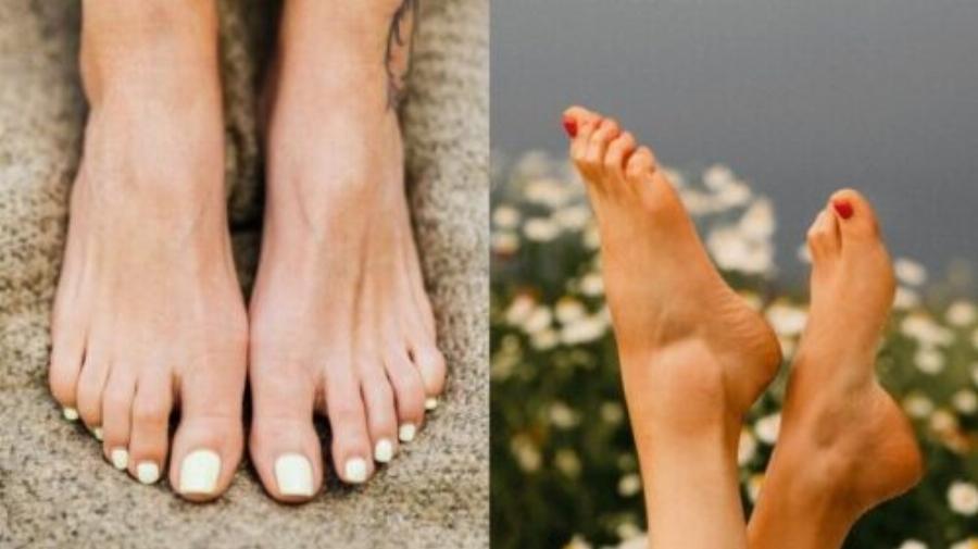 Νύχια και υγεία: Έξι ανησυχητικά σημάδια – Με ποιες παθήσεις συνδέονται πραγματικά