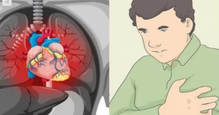 Αν στο δέρμα σας συμβαίνει αυτό, έχετε αυξημένο κίνδυνο καρδιακής προσβολής