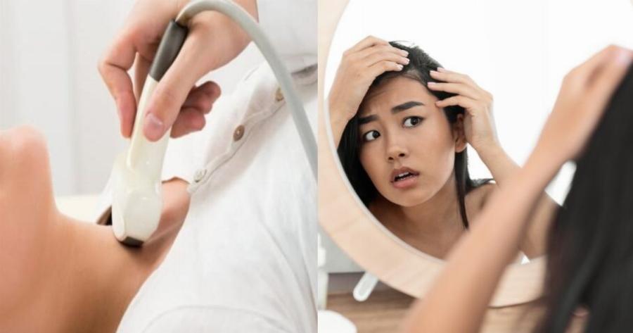 Αν χάνετε τρίχες από αυτό το σημείο, θέλει έλεγχο ο θυρεοειδής σας… ΧΘΕΣ