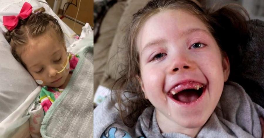 4χρονη έπαθε εγκεφαλική βλάβη από αποσμητικό, γιατί η μητέρα της έκανε ένα λάθος που κάνουν πολλοί γονείς