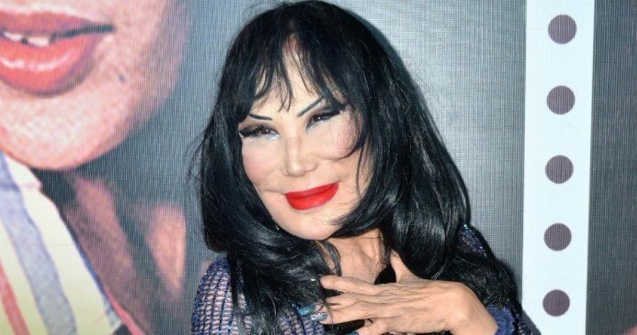 Ήταν γνωστή για την εντυπωσιακή φυσική ομορφιά της — και μόλις τη δείτε πριν από την επέμβαση, θα καταλάβετε γιατί