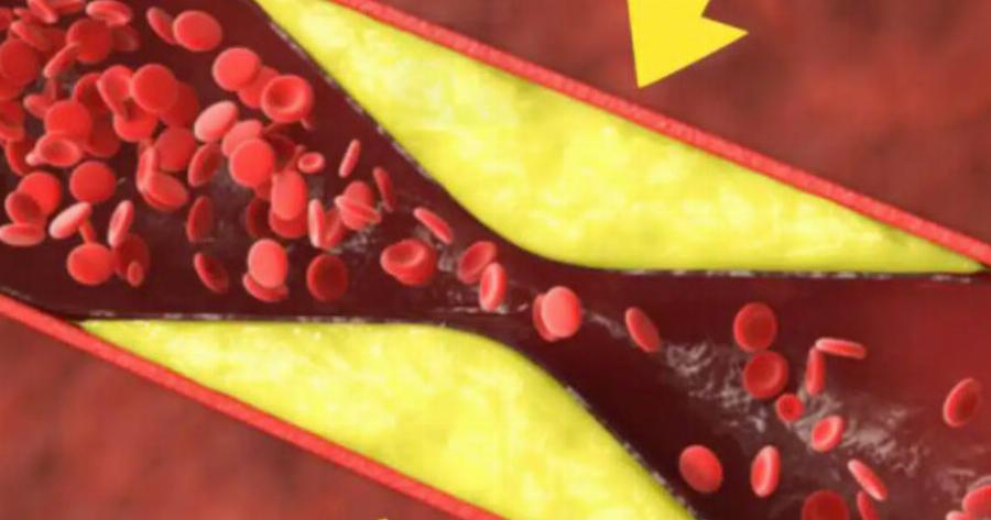 Τα καλύτερα φρούτα για να ξεβουλώσετε και να καθαρίσετε τα αιμοφόρα αγγεία σας