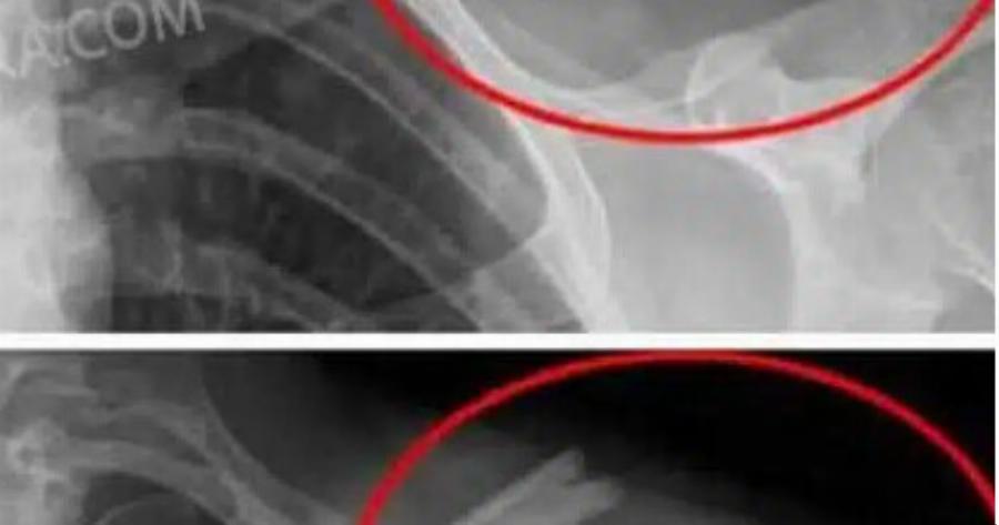 Auτό το ποτό θα καταστρέψει τα κόκαλα σας από μέσα αλλά όλοι το πίνουν