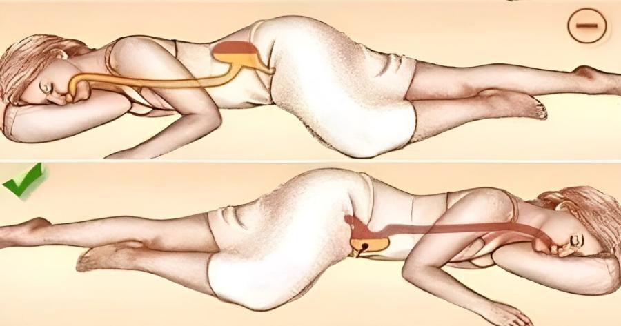 Ο ύπνος στην αριστερή πλευρά επnpεάζει την uγεiα σου με τρόπους που δεν θα είχες σκεφτεί ποτέ…