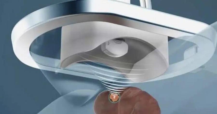 Δημιουργήθηκε ρομπότ που καταστρέφει καρκινώματα με υπέρηχο