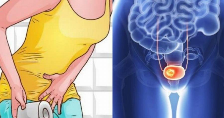 Ποια συμπτώματα μπορεί να κρύβουν έναν καρκίνο στην ουροδόχο κύστη και δεν τα φανταζόσασταν