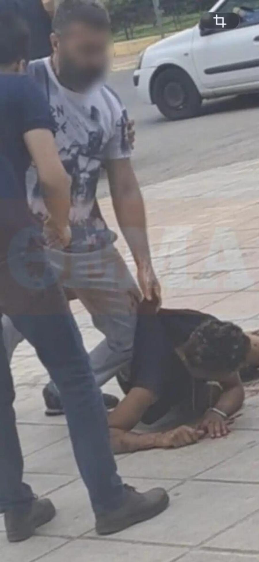 Ανατροπή στην υπόθεση της Καλλιθέας: Οι δύο Αιγύπτιοι δεν ήταν διαρρήκτες, ο οδοντίατρος τους ξυλοφόρτωσε με το ρόπαλο ενώ κάθονταν στη στάση