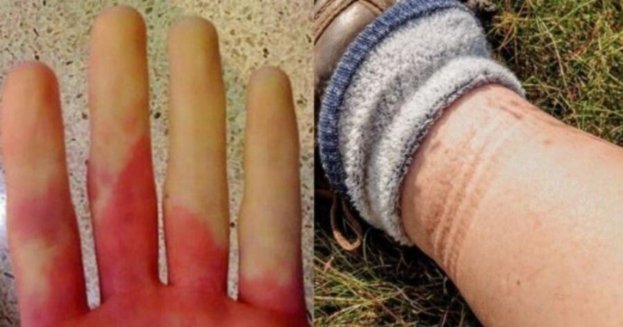 Ανακοπή καρδιάς: Τι θα νιώσετε μέρες πριν σας συμβεί – 6 συμπτώματα που πρέπει να αναγνωρίσετε εγκαίρως