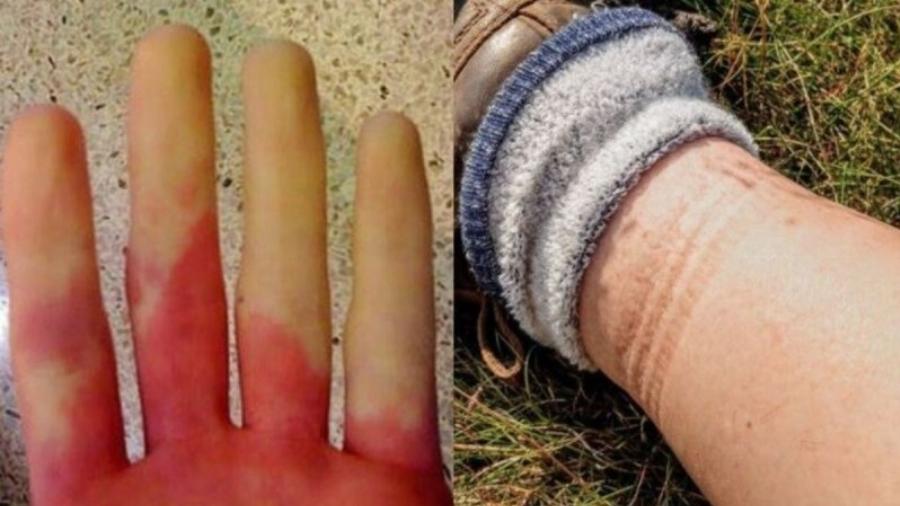 Ανακοπή καρδιάς: Τι θα νιώσετε μέρες πριν σας συμβεί – 6 συμπτώματα που πρέπει να αναγνωρίσετε εγκαίρως