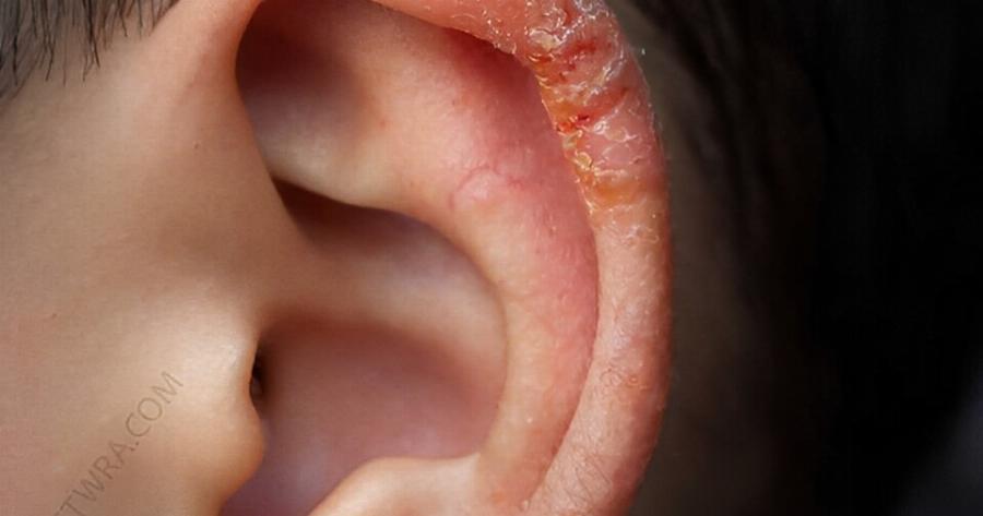 Είδα αυτό στο αυτί του γιου μου και το ραντεβού με τον γιατρό αργεί