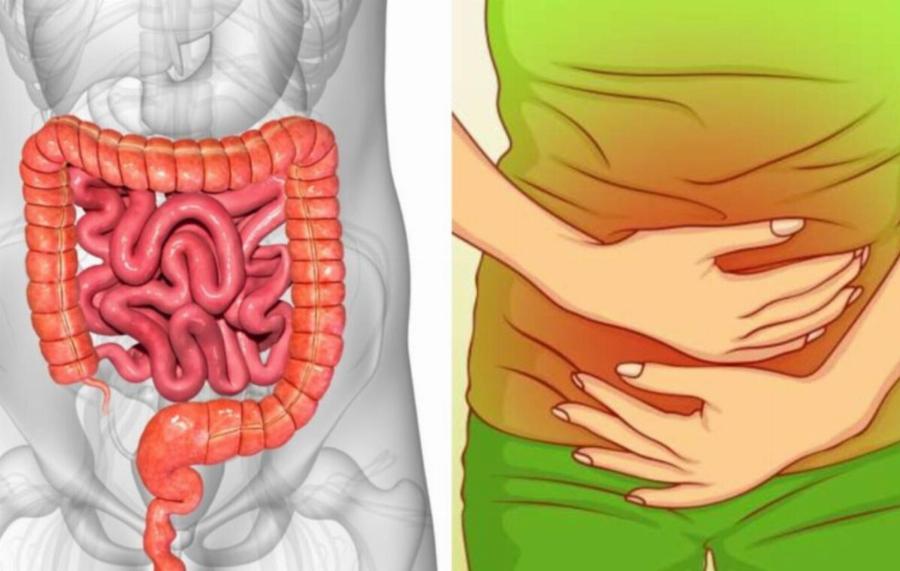 Αέρια στο έντερο: Τι δείχνουν για την υγεία μας – Ποιες οι αιτίες και πως να αντιμετωπίσουμε το πρόβλημα