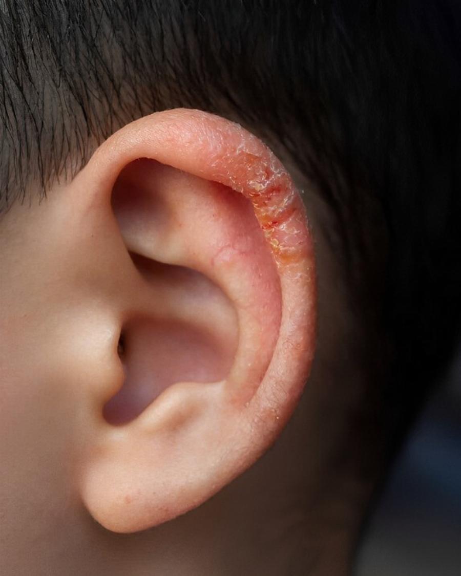 Είδα αυτό στο αυτί του γιου μου και το ραντεβού με τον γιατρό αργεί