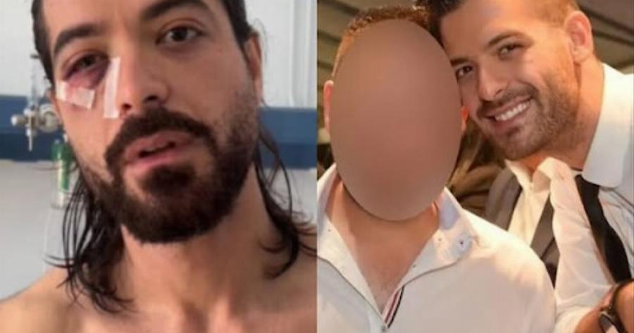 Άρης Μουγκοπέτρος: Η «ύποπτη» ανάρτηση του φίλου του λίγο πριν του δώσει την κροτίδα που την κατέβασε αμέσως μετά την έκρηξη – Η 4 λέξεις που έγραφε