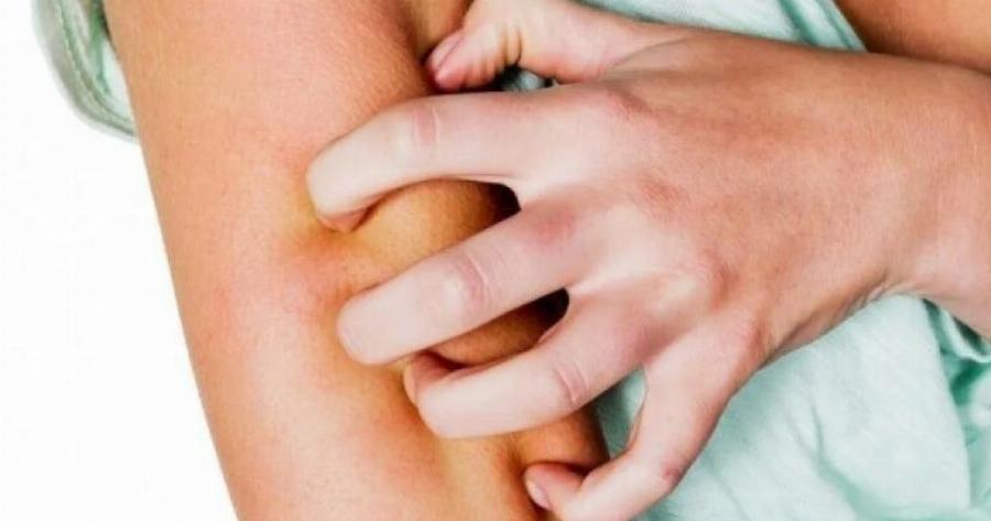 Συναγερμός στα Χανιά – Εμφανίστηκε νορβηγική ψώρα