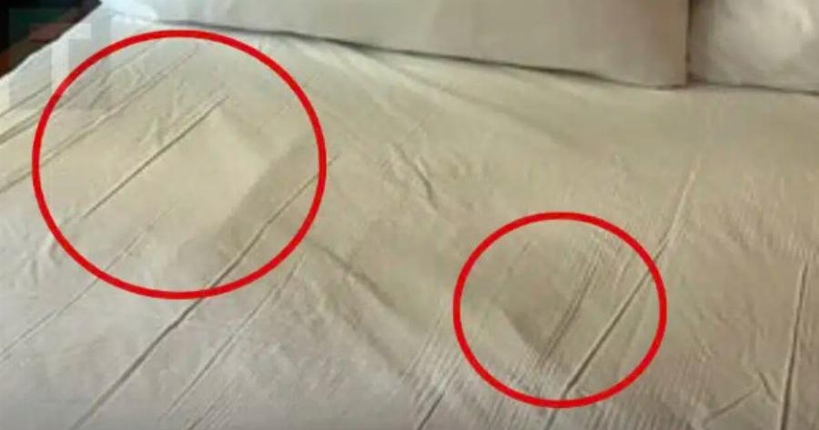 Οι γιατροί προειδοποιούν: Auτό το 1 σημάδι καρκίνου μπορεί να φανεί στα σεντόνια σας