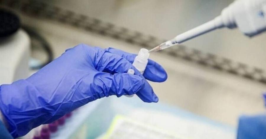 Παγκόσμιος συναγερμός: Βρέθηκαν κρούσματα του θανατηφόρου ιού Μάρμπουργκ – Πώς μεταδίδεται