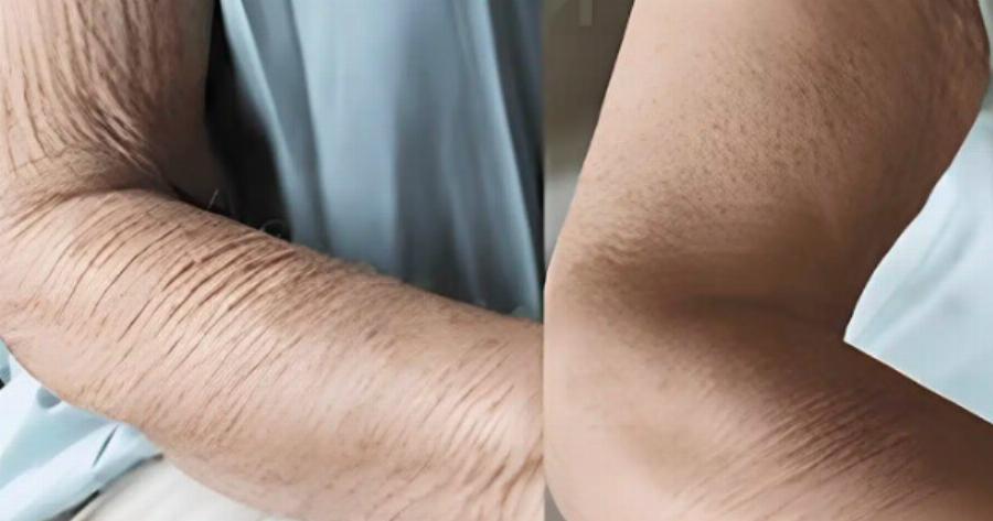 Πώς να φροντίσετε το δέρμα που γερνάει