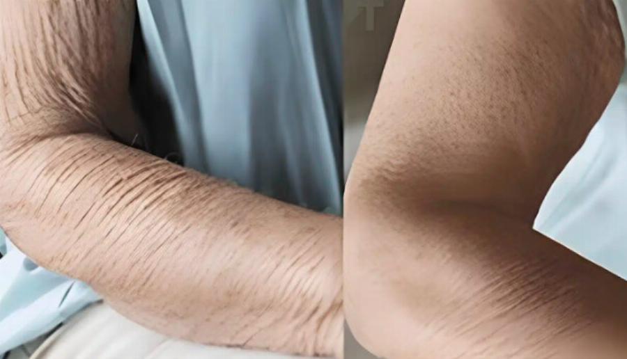 Πώς να φροντίσετε το δέρμα που γερνάει