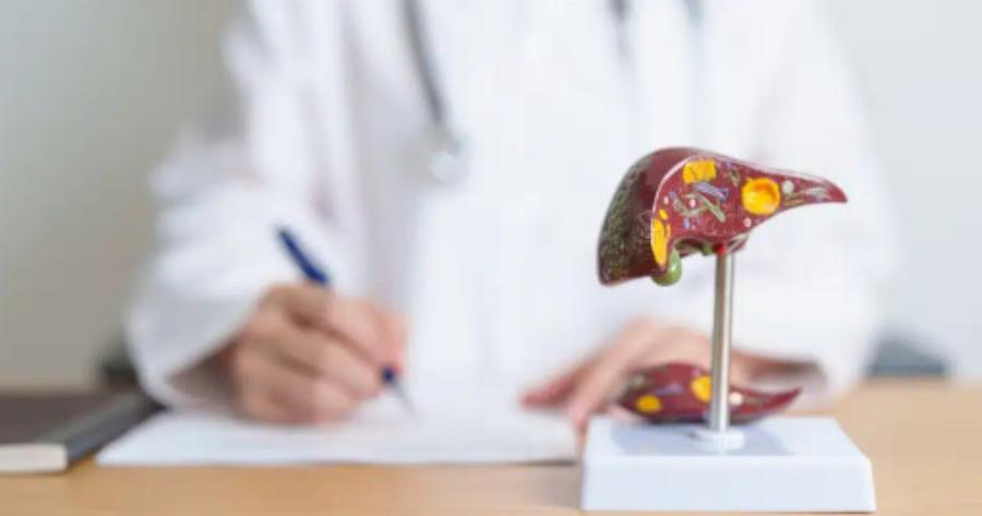 Λιπώδες Ήπαρ: Αιτίες, Συμπτώματα, Θεραπεία & Σπιτικές Θεραπείες