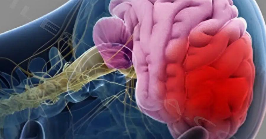 4 πράγματα που πολλοί κάνουν το πρωί και μπορεί να πάθουν εγκεφαλικό, όλες οι ηλικίες πρέπει να τα αποφεύγουν