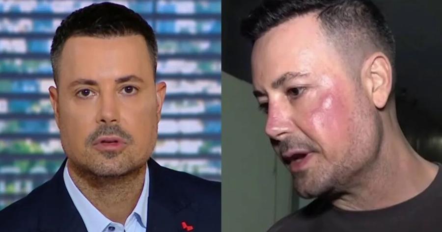 Πέτρος Κουσουλός: Τι είναι η γυροειδής αλωπεκία που τον ταλαιπωρεί – Η μάχη με το αυτοάνοσο και η νέα διάγνωση