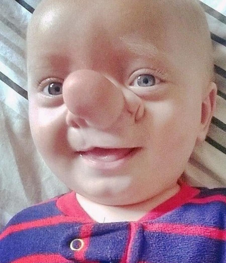 Έγκυος είδε στον υπέρηχο το μωρό της και την έλουσε κρύος ιδρώτας …