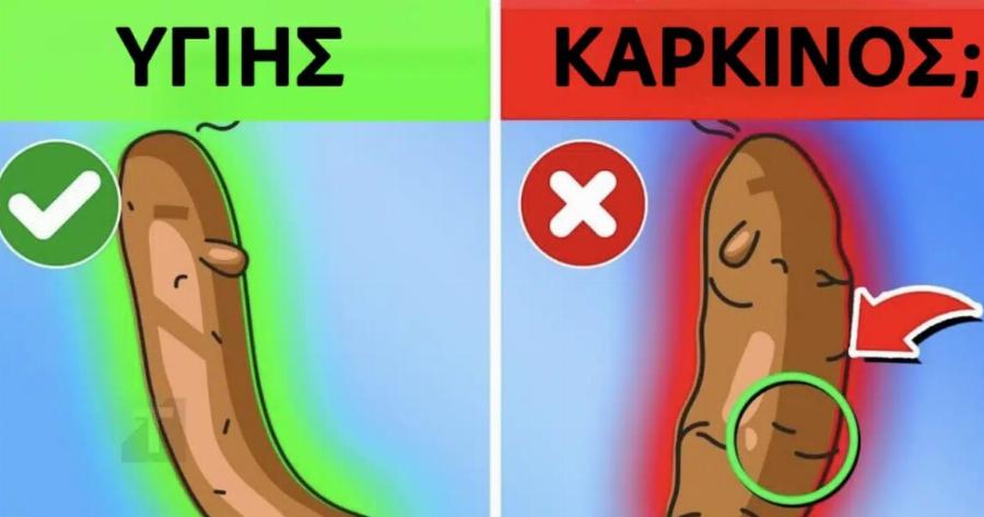 Τι αποκαλύπτει το χρώμα των κοπράνων σας για την υγεία σας