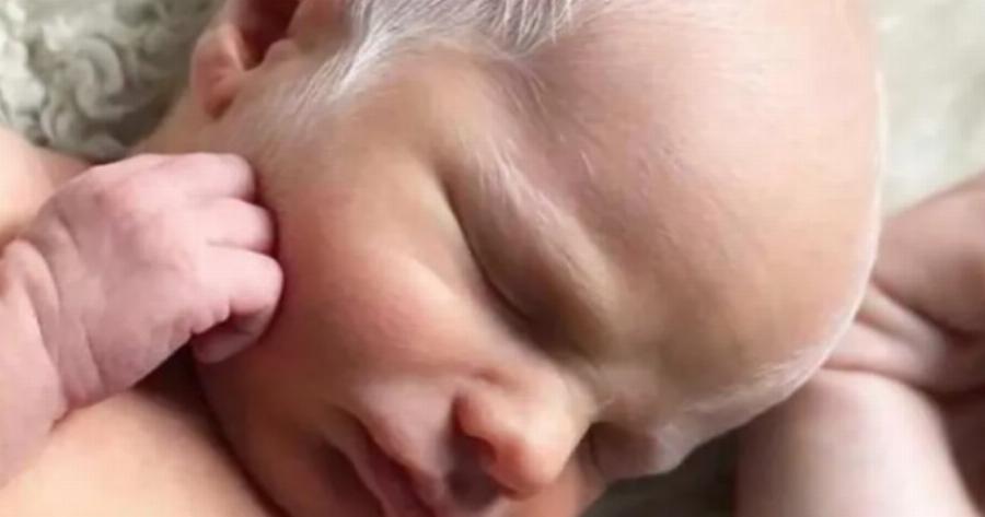 “Το μωρό κοροϊδευόταν για τα λευκά του μαλλιά”: Πώς μοιάζει τώρα;