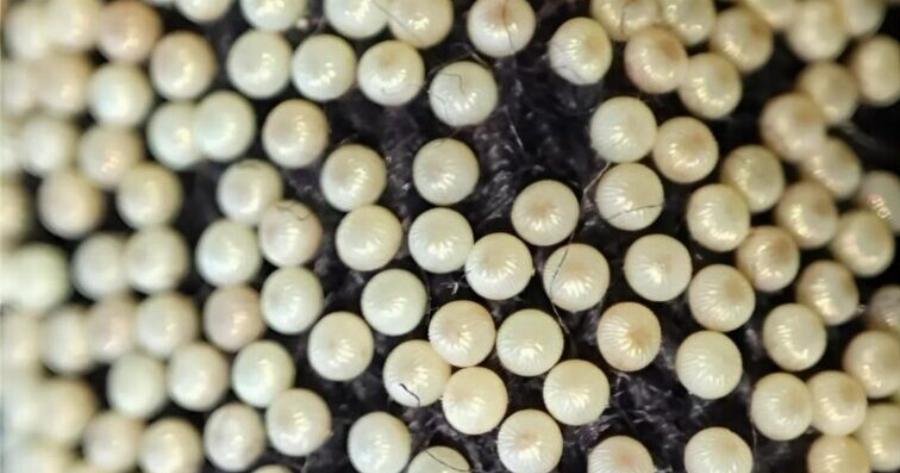 «Έπλενα τα ρούχα του γιου μου και παρατήρησα κάτι παράξενες κιτρινωπές μπάλες στο μανίκι ενός από τα πουλόβερ του. Tpoμoκpατnθnκα όταν συνειδητοποίησα τι ήταν»