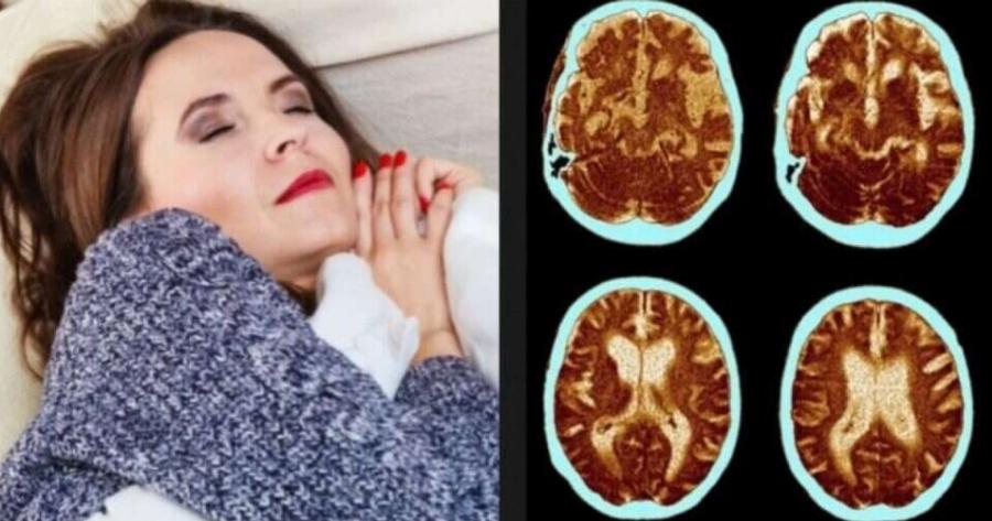 Μεσημεριανός ύπνος: Το “αθώο” σημάδι που αποτελεί προάγγελο του Αλτσχάιμερ και οι περισσότεροι αγνοούν