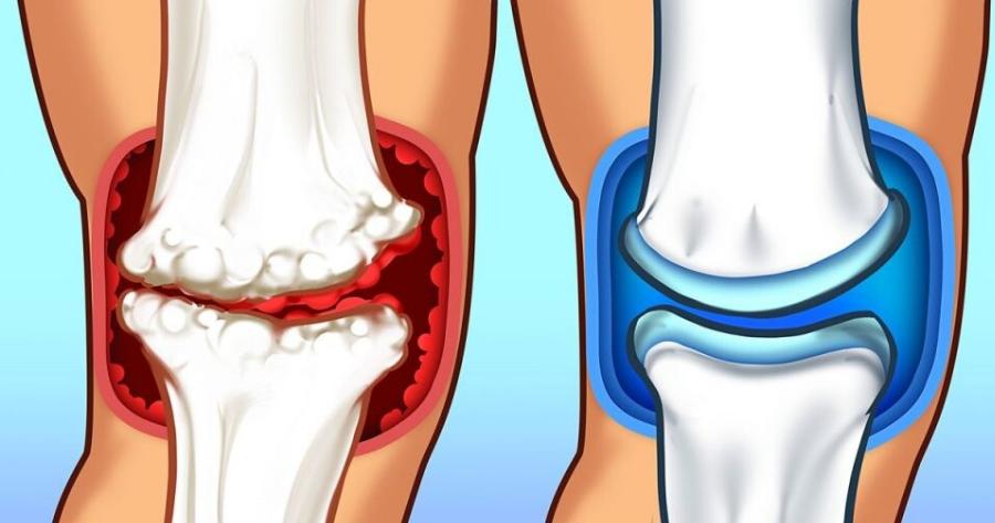Το ρόφημα που χτίζει γερά οστά και δεν είναι το γάλα που φανταστήκατε όλοι αμέσως
