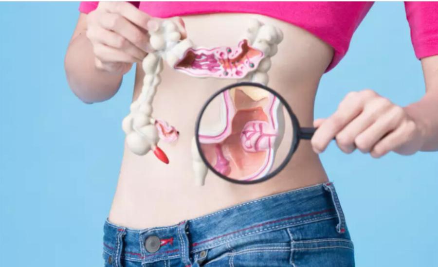 Τόσο καιρό χρειάζεται ένας πολύποδας του εντέρου για να εξελιχθεί σε καρκίνο