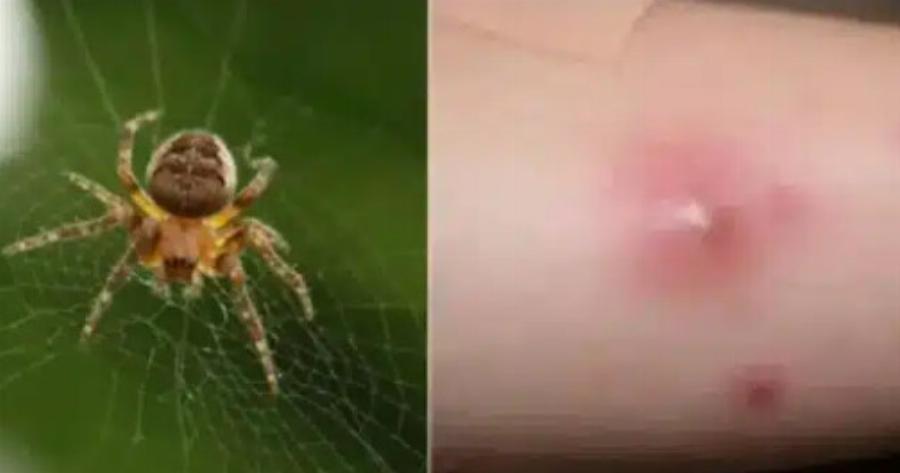 Σοκ Δεν ήταν αράχνη τελικά: Όλα τούμπα στον Πύργο, από αυτό πέθανε ο 48χρονος