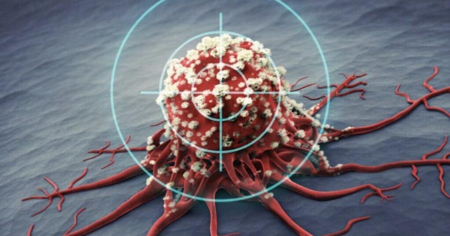 8 από τις καλύτερες αντικαρκινικές τροφές. Ήρθε η ώρα να τις προσθέσετε στη διατροφή σας