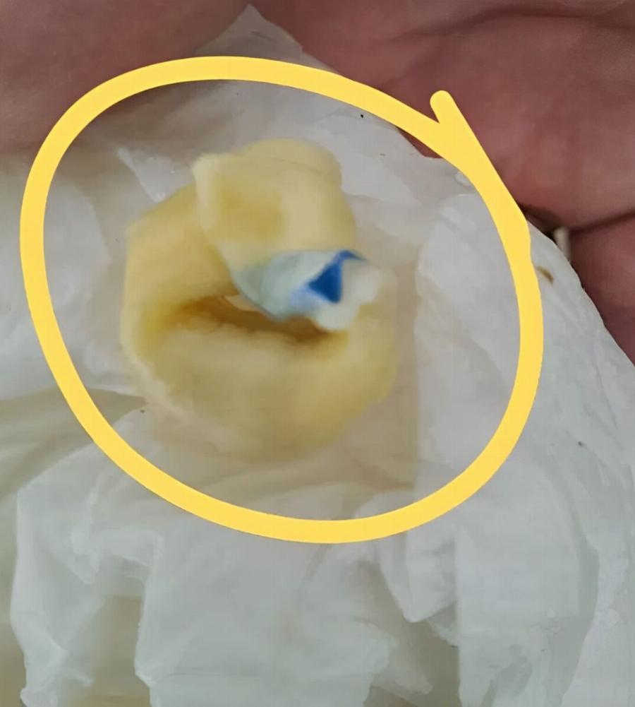 Σοκ στην Πάτρα: Δείτε τι βρήκε καταναλώτρια μέσα σε ζυμαρικά μεγάλης εταιρείας