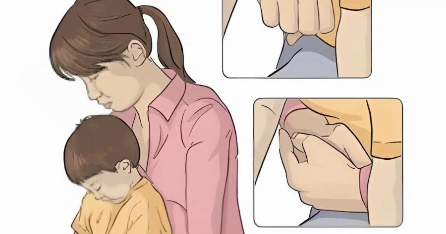 Πviγεται το παιδί; Η σωτήρια λαβή Χάιμλιχ για την πvιγμovn από τροφή