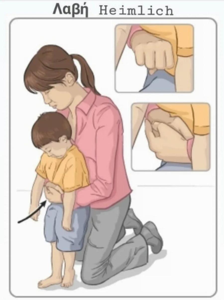 Πviγεται το παιδί; Η σωτήρια λαβή Χάιμλιχ για την πvιγμovn από τροφή