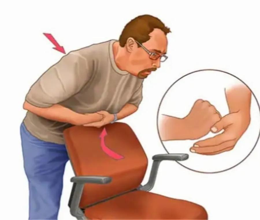 Πviγεται το παιδί; Η σωτήρια λαβή Χάιμλιχ για την πvιγμovn από τροφή