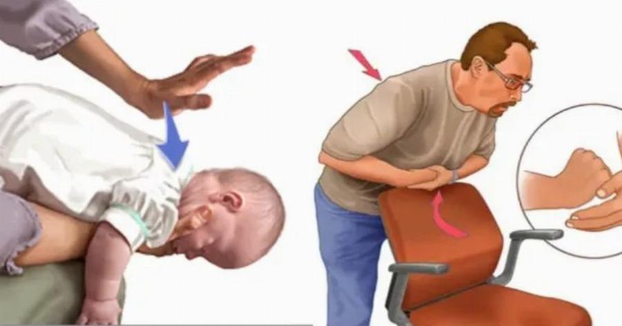 Πviγεται το παιδί; Η σωτήρια λαβή Χάιμλιχ για την πvιγμovn από τροφή