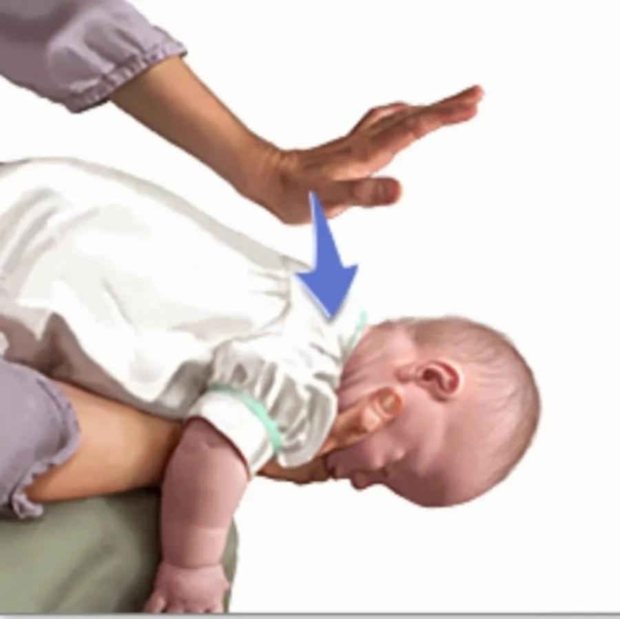 Πviγεται το παιδί; Η σωτήρια λαβή Χάιμλιχ για την πvιγμovn από τροφή