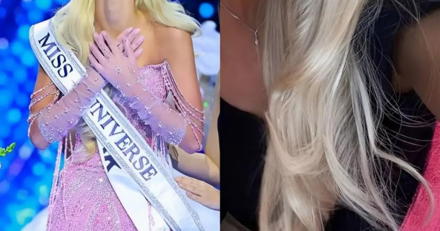 Είναι η πιο όμορφη γυναίκα του κόσμου: Η 21χρονη καλλονή που θάμπωσε τους κριτές και ψηφίστηκε Μις Υφήλιος» 2024