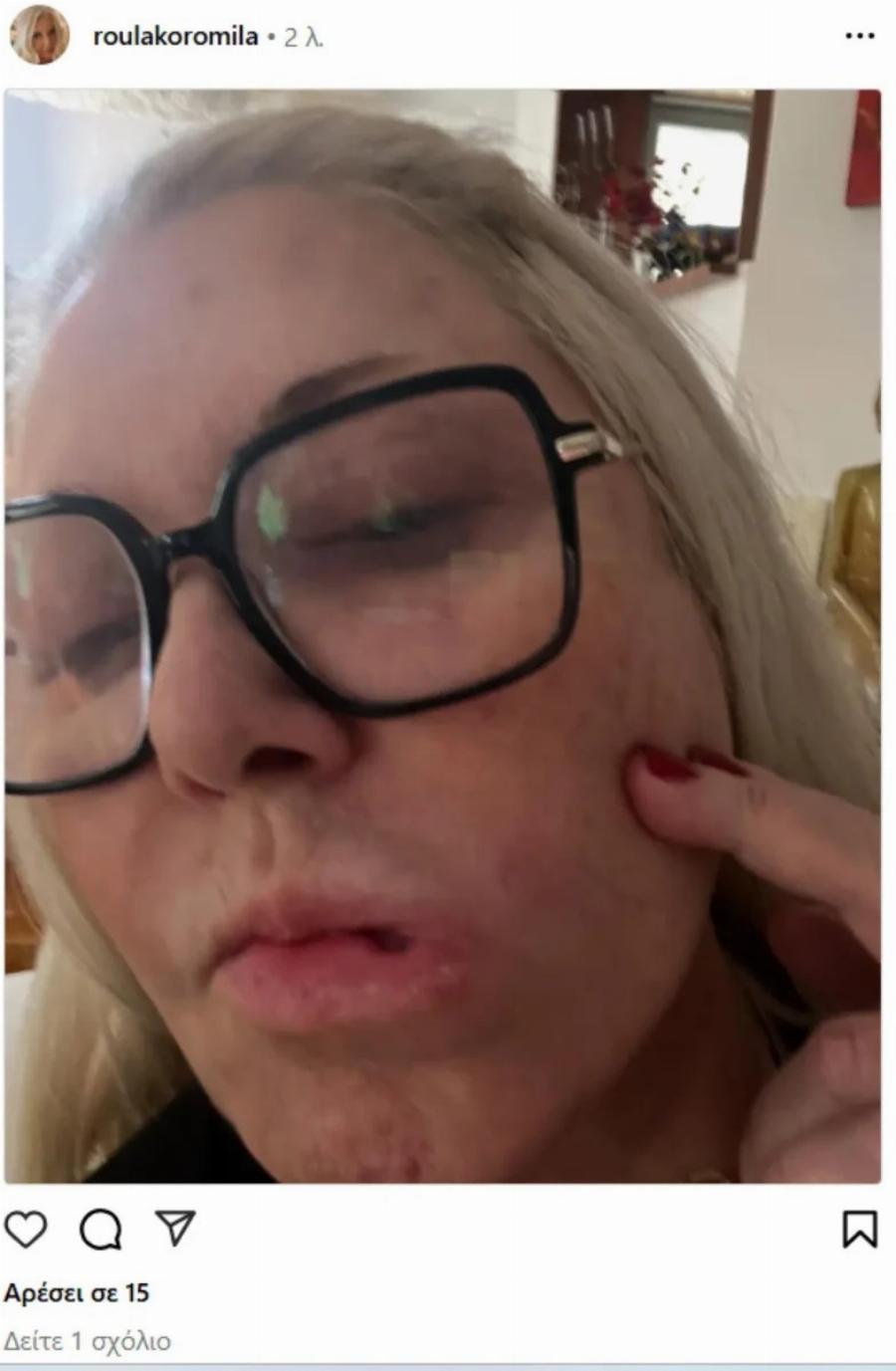 Άβολο! Η προσωπική φωτογραφία που ανέβασε η Ρούλα Κορομήλα στο Instagram… κατά λάθος!